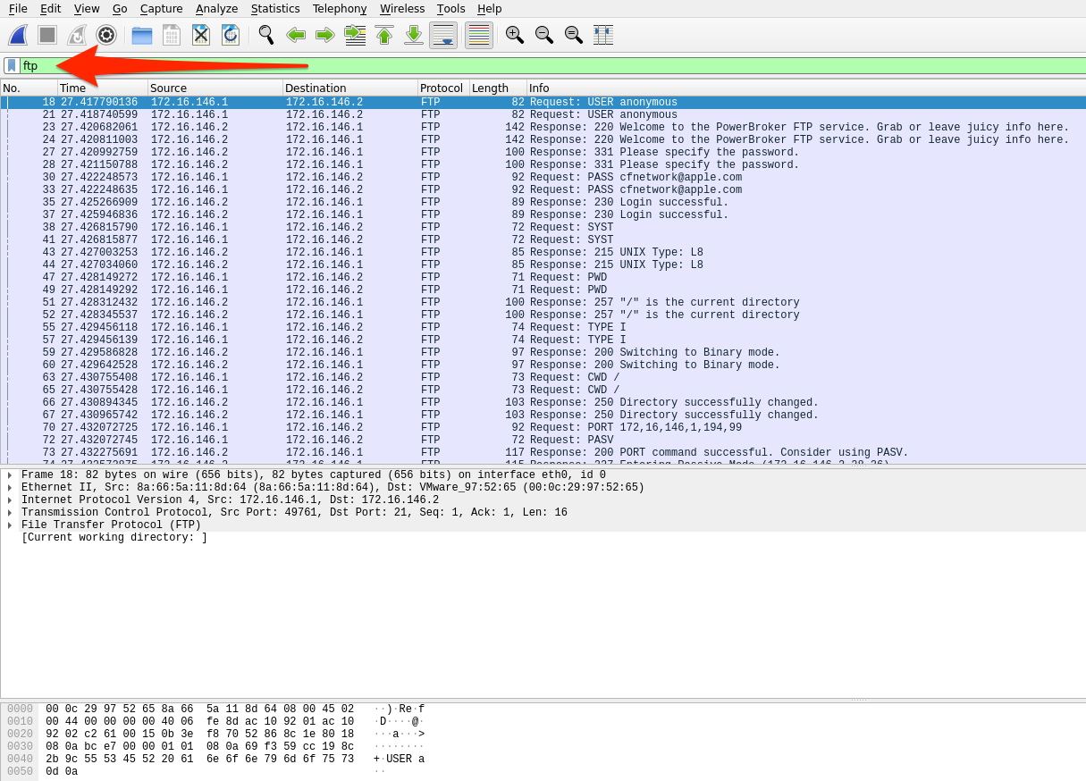 FTP disector